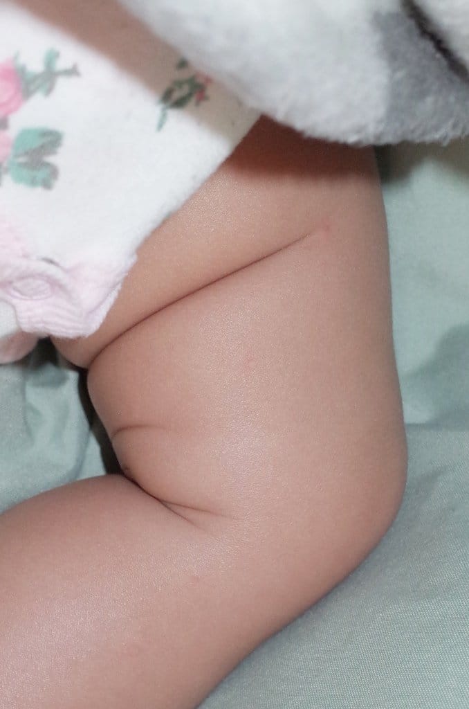 【育兒分享】媽咪寶貝最愛，打造亮麗氣色 Judy City  Cebelia 絲寶麗 寡胜肽系列