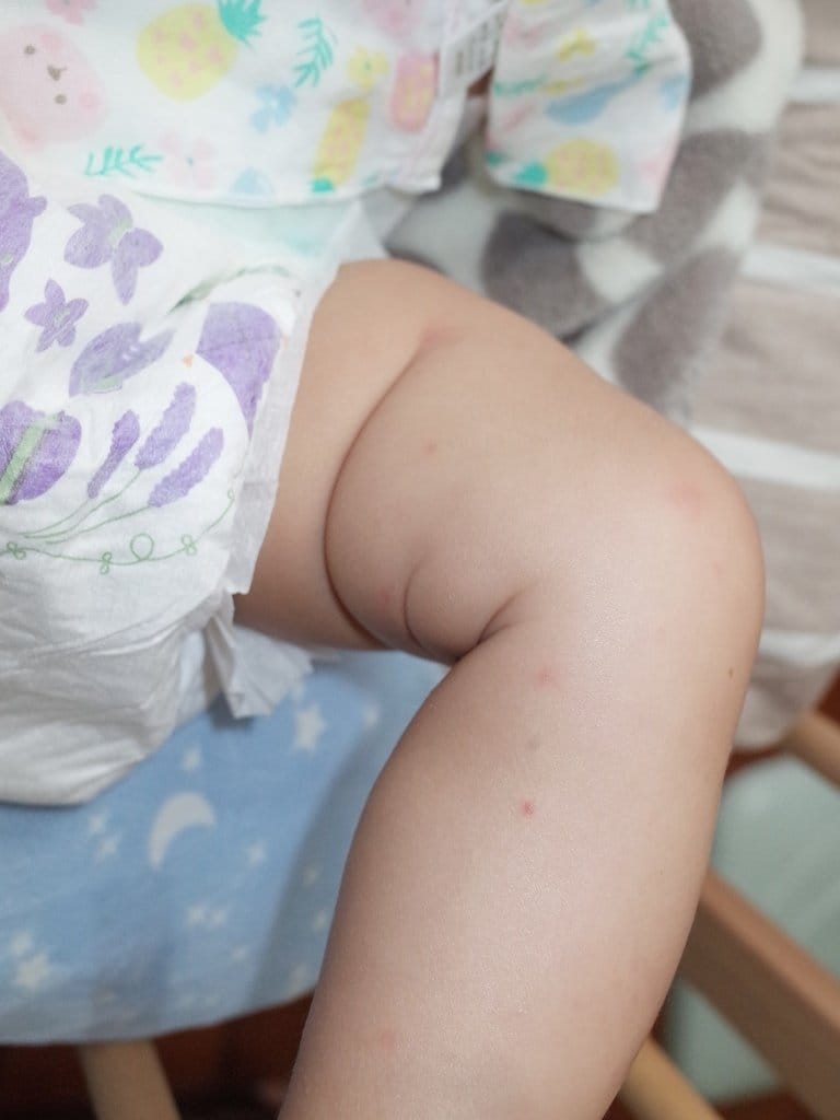 【育兒分享】媽咪寶貝最愛，打造亮麗氣色 Judy City  Cebelia 絲寶麗 寡胜肽系列